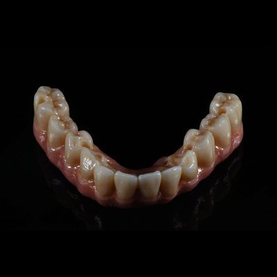 quality  Fixed Restorations Full Arch Zirconia Implant Bridge Denture Teeth factory