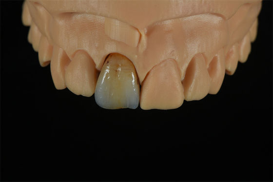 quality  Affordable Zirconia Crowns with Custom Color Staining - China Dental Lab factory